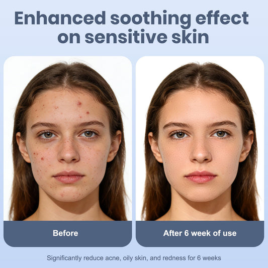 Why Dermatologists Recommend Disposable Face Towels for Sensitive Skin
